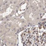 UFC1 Antibody in Immunohistochemistry (IHC)