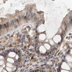 UFC1 Antibody in Immunohistochemistry (IHC)