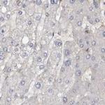 UFC1 Antibody in Immunohistochemistry (IHC)