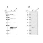 UFC1 Antibody in Western Blot (WB)