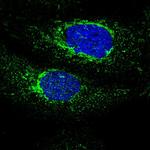 MECR Antibody in Immunocytochemistry (ICC/IF)