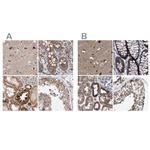 MECR Antibody in Immunohistochemistry (IHC)