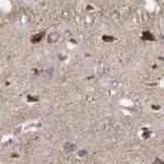 MECR Antibody in Immunohistochemistry (IHC)