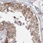 MECR Antibody in Immunohistochemistry (IHC)