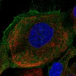 Folliculin Antibody in Immunocytochemistry (ICC/IF)