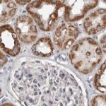 MRPL18 Antibody in Immunohistochemistry (IHC)