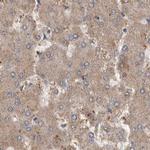 MRPL18 Antibody in Immunohistochemistry (IHC)