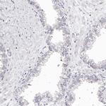 CDCA8 Antibody in Immunohistochemistry (Paraffin) (IHC (P))