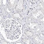 CDCA8 Antibody in Immunohistochemistry (IHC)