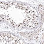 CDCA8 Antibody in Immunohistochemistry (IHC)