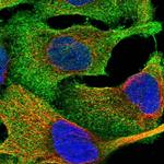 FARS2 Antibody in Immunocytochemistry (ICC/IF)