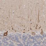 C21orf59 Antibody in Immunohistochemistry (Paraffin) (IHC (P))