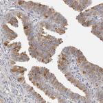 C21orf59 Antibody in Immunohistochemistry (Paraffin) (IHC (P))