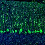 C21orf59 Antibody in Immunohistochemistry (Paraffin) (IHC (P))