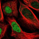 UBE2E2 Antibody in Immunocytochemistry (ICC/IF)