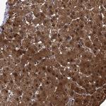 ZNF274 Antibody in Immunohistochemistry (Paraffin) (IHC (P))