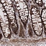 DAD1 Antibody in Immunohistochemistry (Paraffin) (IHC (P))