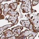 DAB2 Antibody in Immunohistochemistry (Paraffin) (IHC (P))