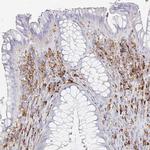 DAB2 Antibody in Immunohistochemistry (Paraffin) (IHC (P))