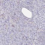 DAB2 Antibody in Immunohistochemistry (IHC)