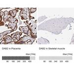 DAB2 Antibody