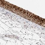 BUD31 Antibody in Immunohistochemistry (Paraffin) (IHC (P))