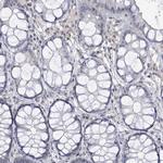 Centrin 2 Antibody in Immunohistochemistry (Paraffin) (IHC (P))