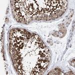 Centrin 2 Antibody in Immunohistochemistry (Paraffin) (IHC (P))