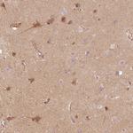 APLP1 Antibody in Immunohistochemistry (Paraffin) (IHC (P))