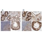 LRRC16A Antibody in Immunohistochemistry (IHC)