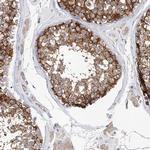 LRRC16A Antibody in Immunohistochemistry (IHC)