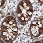 LRRC16A Antibody in Immunohistochemistry (IHC)