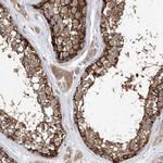 LRRC16A Antibody in Immunohistochemistry (IHC)