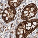 LRRC16A Antibody in Immunohistochemistry (IHC)