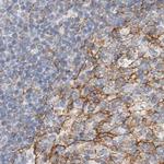 LRRC16A Antibody in Immunohistochemistry (IHC)