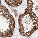 LRRC16A Antibody in Immunohistochemistry (IHC)