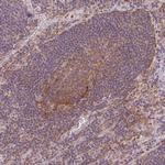 MTHFD1L Antibody in Immunohistochemistry (IHC)