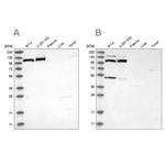 MTHFD1L Antibody in Western Blot (WB)