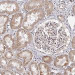 TIMM17B Antibody in Immunohistochemistry (Paraffin) (IHC (P))