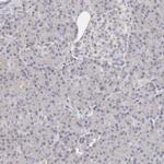 TIMM17B Antibody in Immunohistochemistry (Paraffin) (IHC (P))