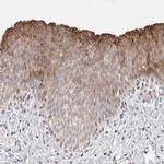 TIMM17B Antibody in Immunohistochemistry (IHC)