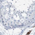 RGN Antibody in Immunohistochemistry (IHC)