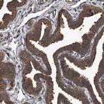 Kir2.1 (KCNJ2) Antibody in Immunohistochemistry (IHC)