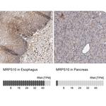 MRPS10 Antibody in Immunohistochemistry (IHC)