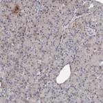 MRPS10 Antibody in Immunohistochemistry (IHC)