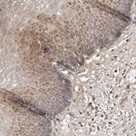 MRPS10 Antibody in Immunohistochemistry (IHC)