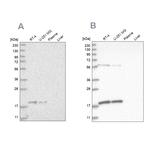 MRPS10 Antibody in Western Blot (WB)