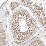 RAB23 Antibody in Immunohistochemistry (Paraffin) (IHC (P))