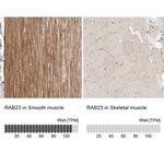 RAB23 Antibody