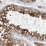 BAP29 Antibody in Immunohistochemistry (Paraffin) (IHC (P))